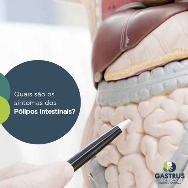 Quais são os sintomas Pólipos intestinais?